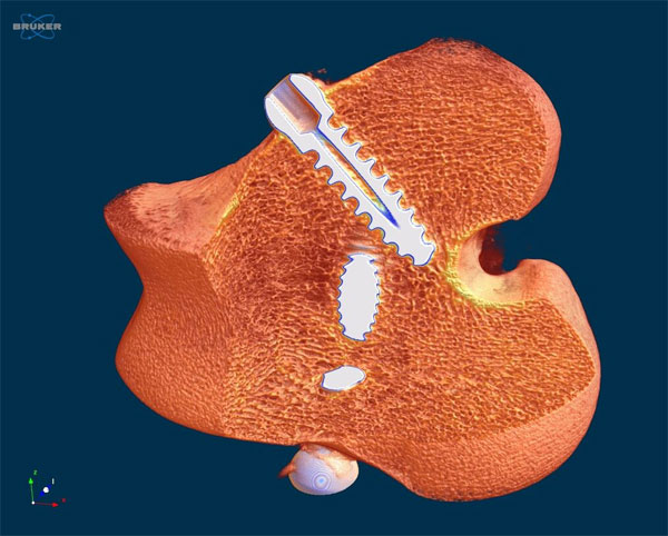 Sheep bone with implants (micro-CT scan)