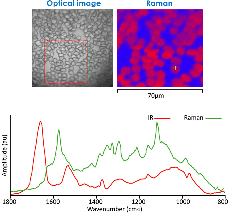 Infrared and Raman on red blood cells
